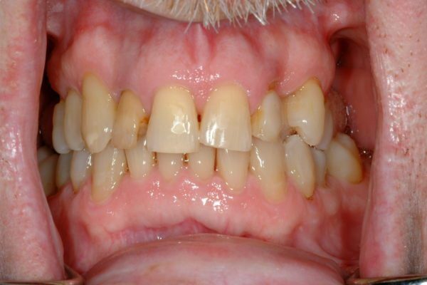 Jacksonville FL Cosmetic Dentistry Before & After Photos